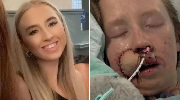 Woman mauled by dog she'd known since puppyhood faces years of surgery