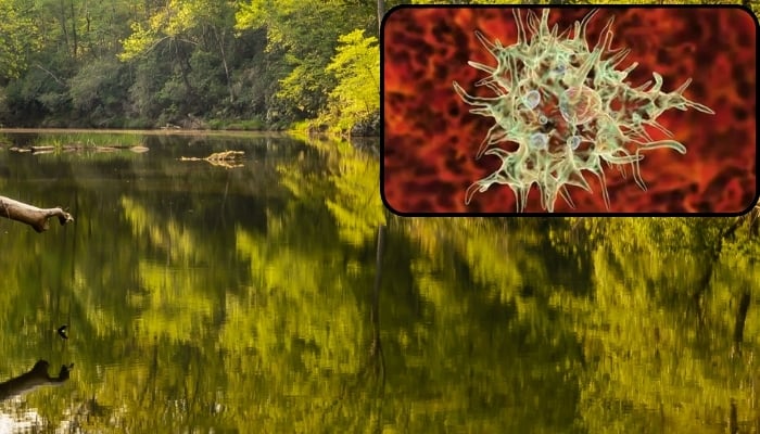NC teen fights for life with brain-eating amoeba infection, found in fresh water
