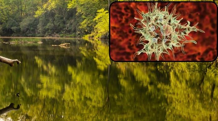 NC teen fights for life with brain-eating amoeba infection, found in fresh water