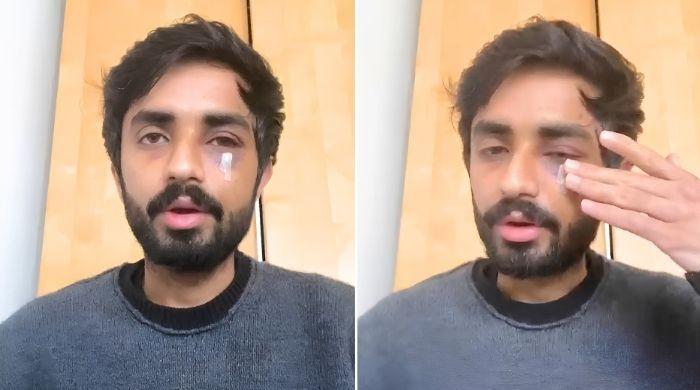 Pakistani student suffers facial fractures in racist attack in Glasgow