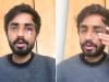 Pakistani student suffers facial fractures in racist attack in Glasgow