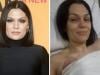 Jessie J announces hiatus as she prepares for 2nd cancer surgery