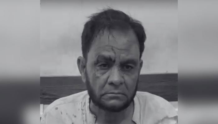 KU Department of Islamic Learning Chairman Arif Saqi is seen after being subjected to torture by a hotel owner’s son and his guards on September 8, 2026. — Geo News/screengrab