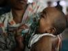 Bangladesh fights world's worst measles outbreak as vaccination gaps fuel spread