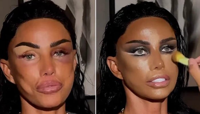 Katies appearance came just hours after she underwent under the knife for new breast implants