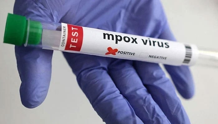 Karachi reports second mpox case in two days, Sindh