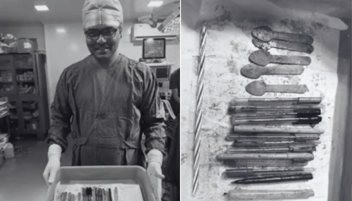 Doctor shows the objects removed from womans stomach in Indias  Andhra Pradesh’s Palnadu district. — Reuters