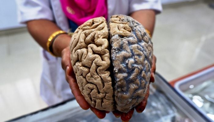 Human brain is actually two separate organs, Stanford study finds