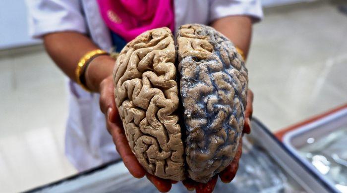 Human brain is actually two separate organs, Stanford study finds