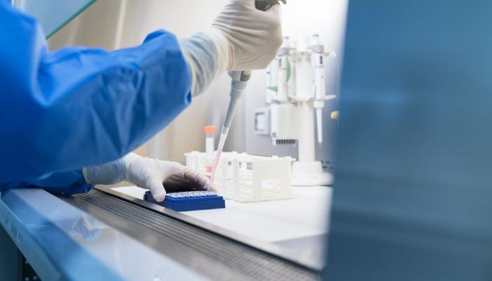 Russia pneumonic plague: Heres how you can stay safe from potentially deadly disease