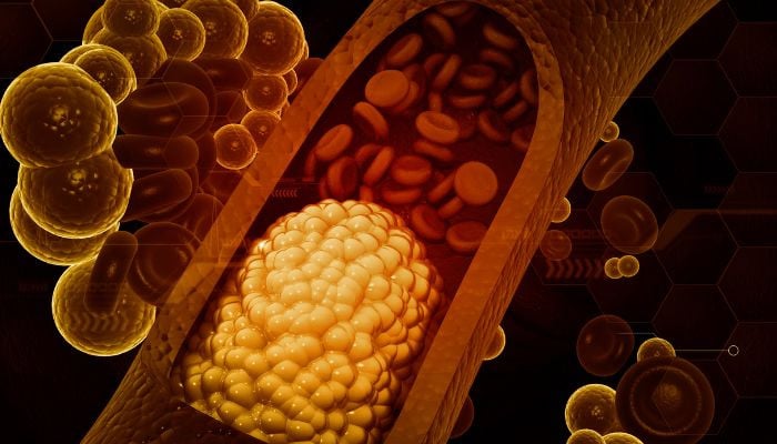 Cardiologists Counter Viral Cholesterol Misinformation