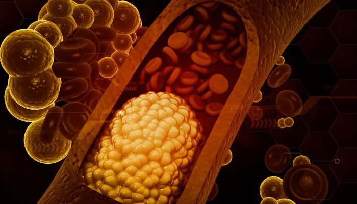 Cholesterol myths debunked: Cardiologists push back as misinformation spreads online