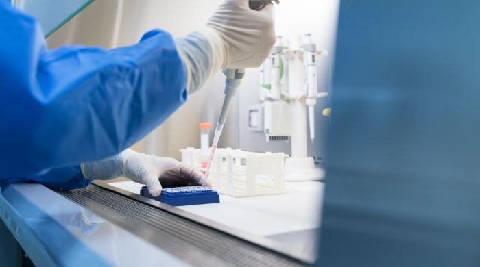 Russia pneumonic plague: Here's how you can stay safe from potentially deadly disease