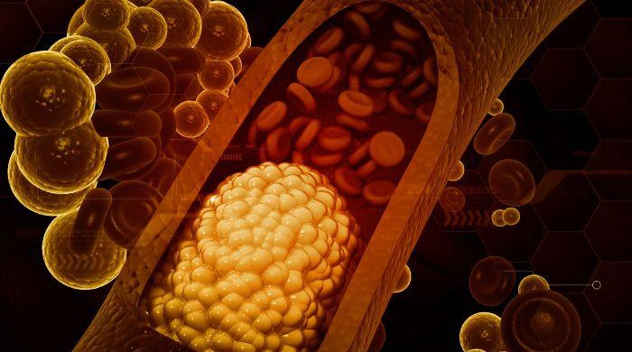 Cholesterol myths debunked: Cardiologists push back as misinformation spreads online