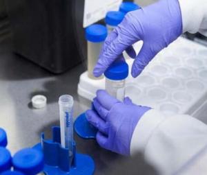 'Mysterious' virus kills Russian lab worker, sends 'hundreds' into quarantine