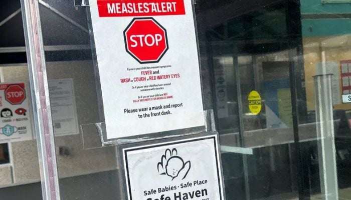 Measles outbreak New York: Here’s how to stay safe