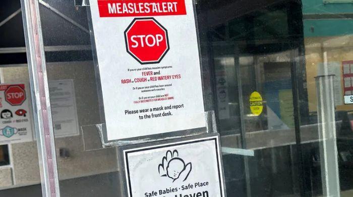 Measles outbreak New York: Here's how to stay safe