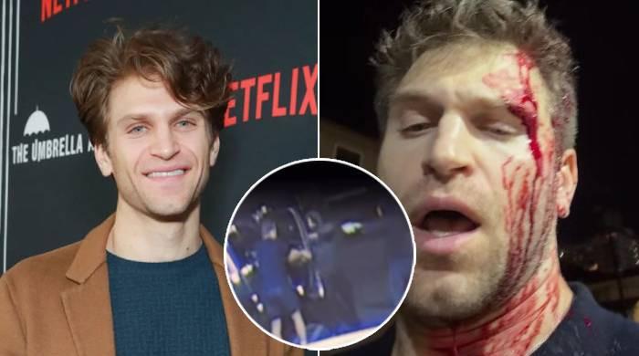 'Pretty Little Liars' star Keegan Allen assaulted, robbed at gunpoint 