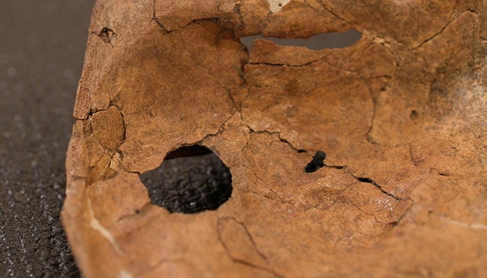 The left scapula of the Neanderthal individual called Shanidar A, who lived about 75,000 years ago, showing a circular hole possibly caused by a sharpened wooden spear, is seen at the University of Cambridge’s Leverhulme Centre for Human Evolutionary Studies in Cambridge, Britain, September 30, 2026. — Reuters